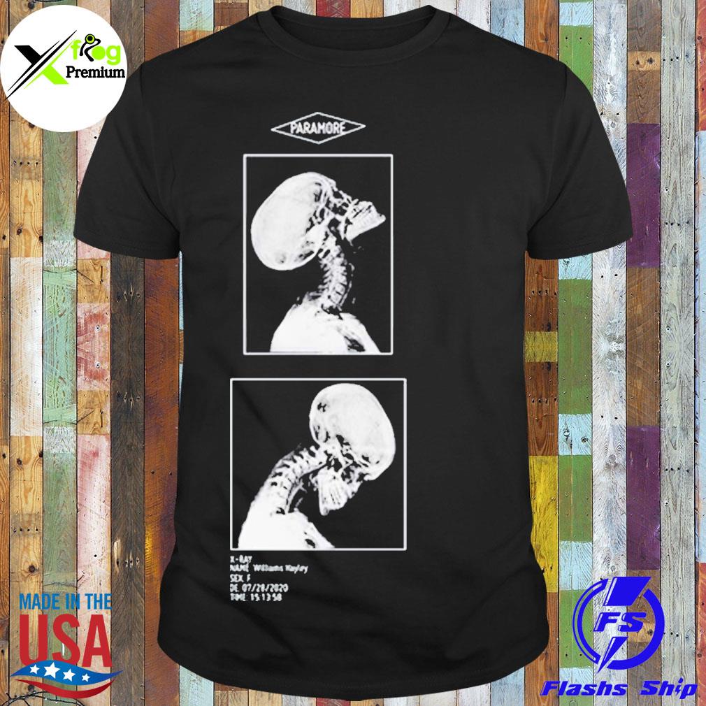 Skeleton x ray williams hayley oh doctors order excessive head banging may lead to spinal fracture shirt